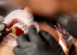 Por qué puede producirse el dolor de encías