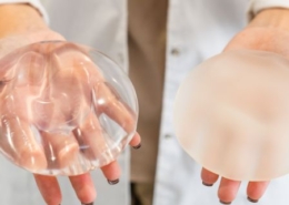 Contractura capsular